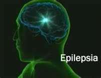 epilepsia